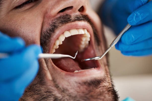 Best Emergency Treatment for Oral Infections in Westmorland, CA