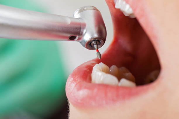 Best Walk-In Emergency Dental Services in Westmorland, CA